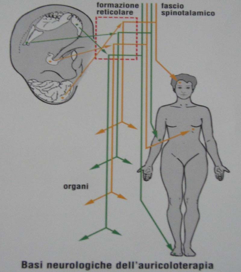 auricoloterapia1