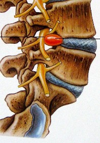 vertebre